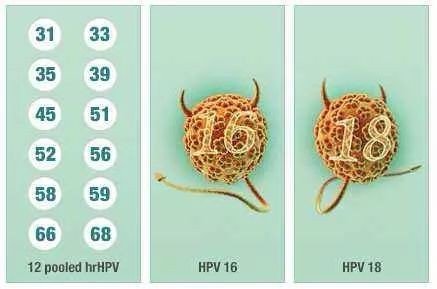 高危型HPV66阳性是什么意思