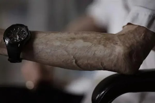 骨瘦如柴的意思