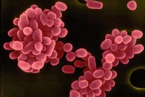 什么是布鲁氏菌？在什么情况下就会被感染？