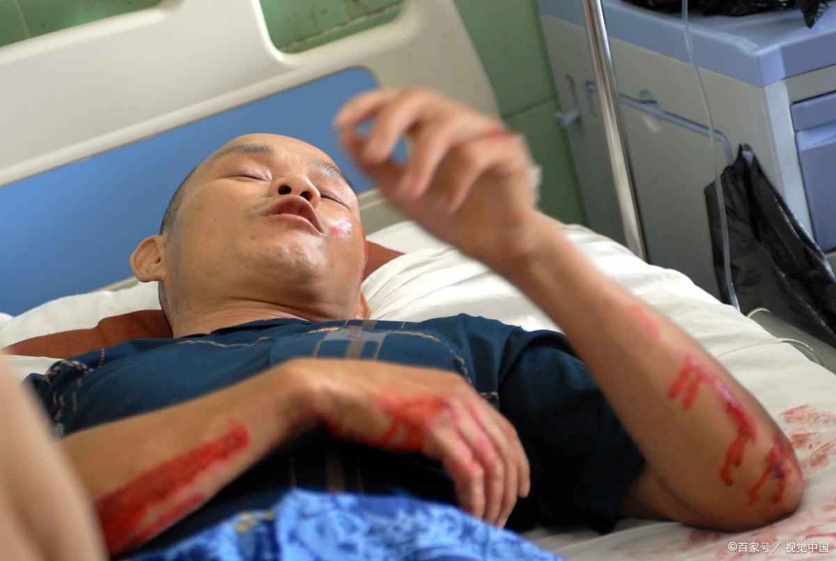 轻伤二级一般判多少年