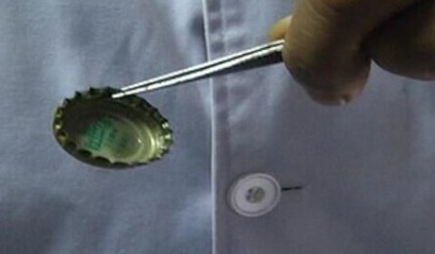 怀化一男子喝酒误吞瓶盖，医生巧用避孕套取出，我们该吸取哪些教训？