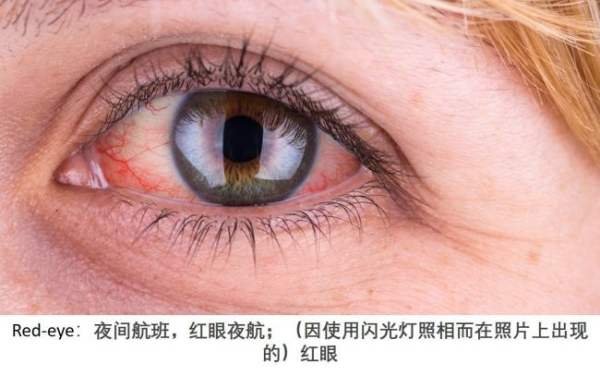 redeye是什么意思