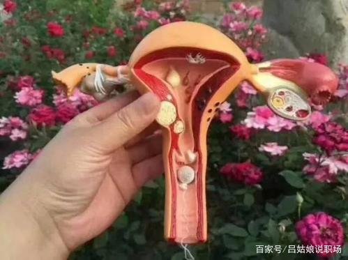 子宫肌瘤怎么治最好?