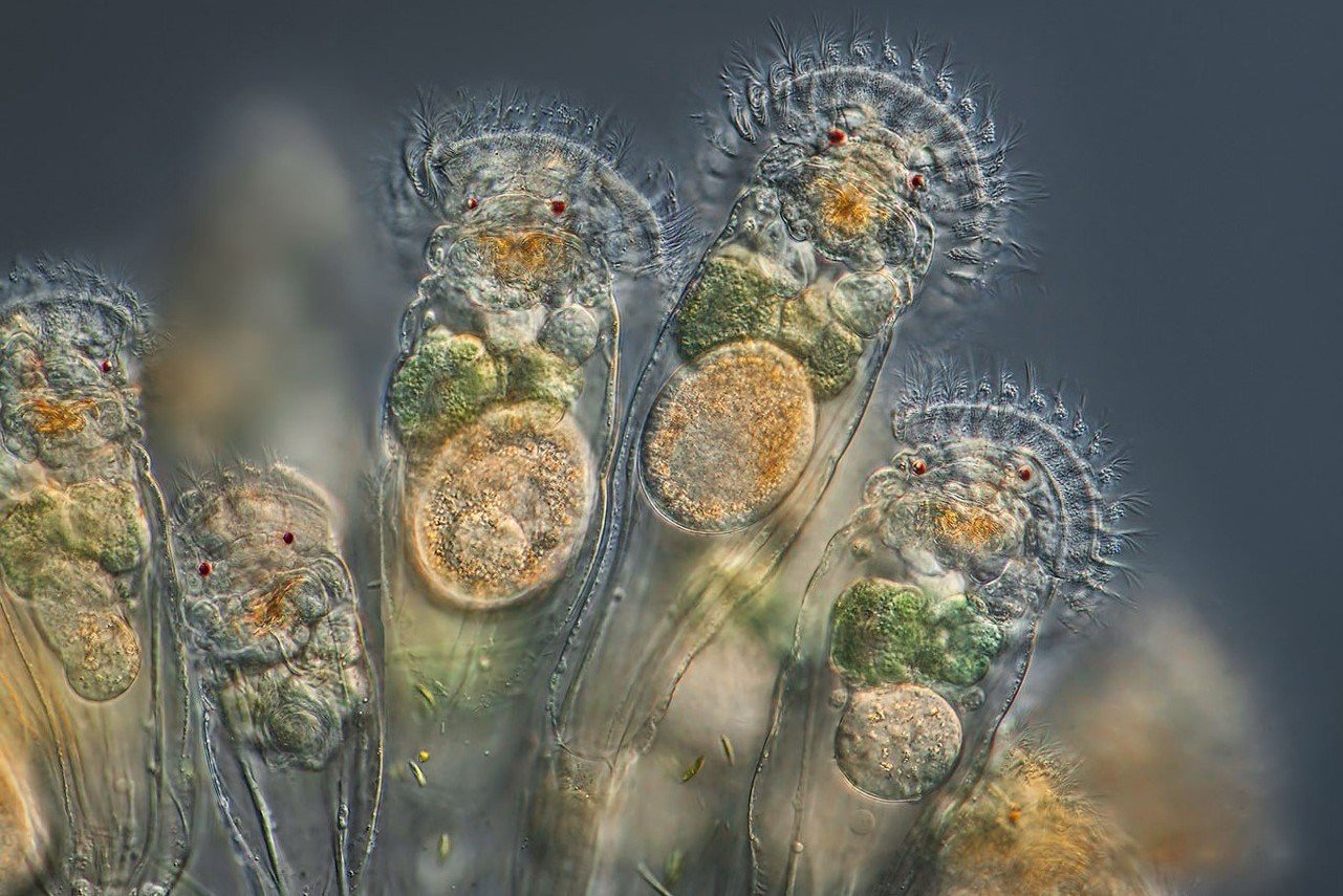 俄罗斯科学家复活2.4万年前微生物，在未来人类是不是也可能会被复活？