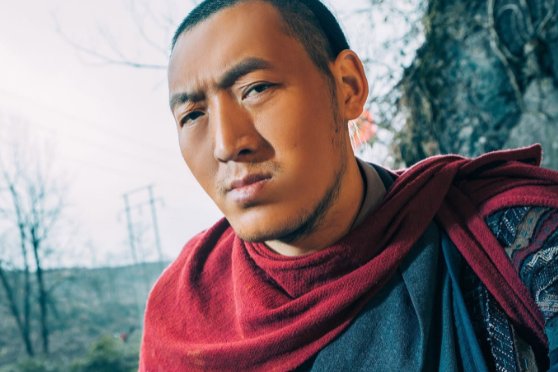 孙明明是巨人症吗