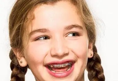 孩子每天戴牙套12小时，谁在贩卖焦虑？