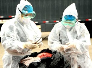 山东2例炭疽病例详情公布，炭疽发病的表现是什么？