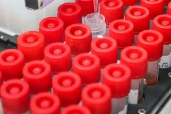 给全国7亿人核酸的公司造假多次，核子华曦的老板为何没有被抓？