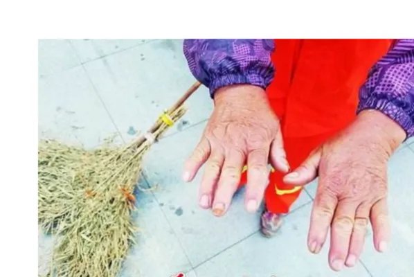 环卫工双手为什么被腐蚀？