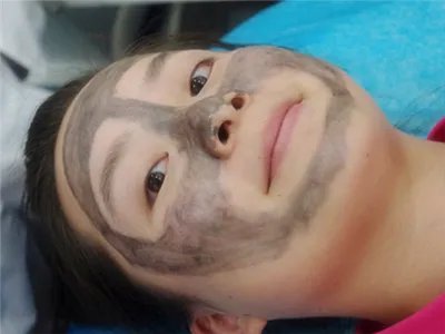 黑脸娃娃去黑头的价格