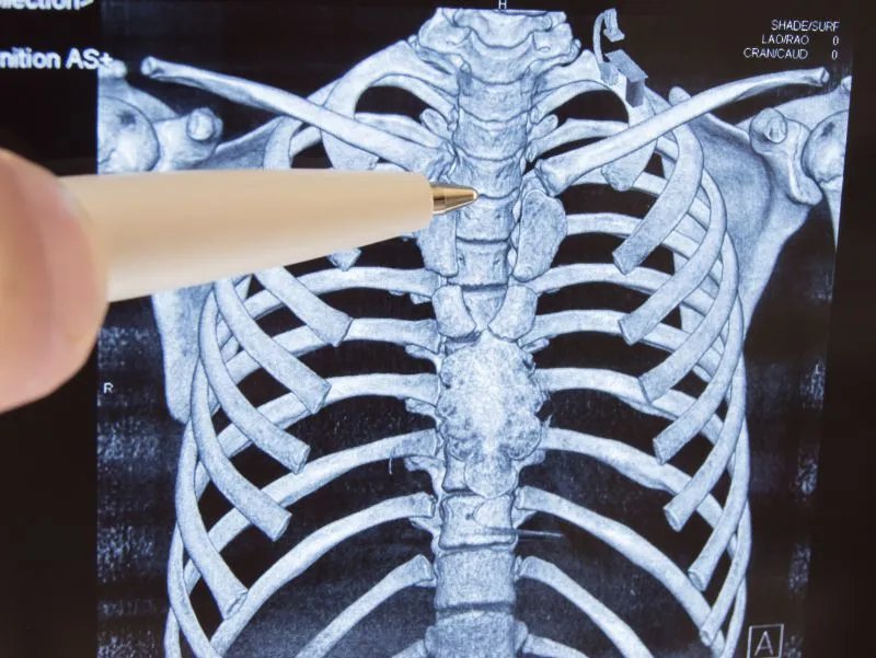 氨糖润骨素的作用