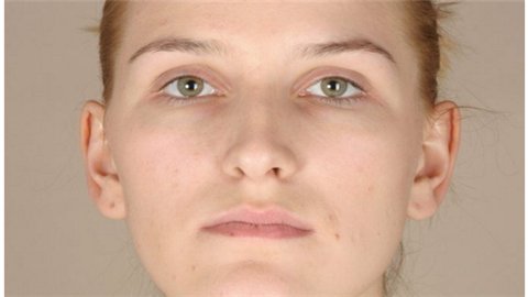 e光嫩肤美白安全吗