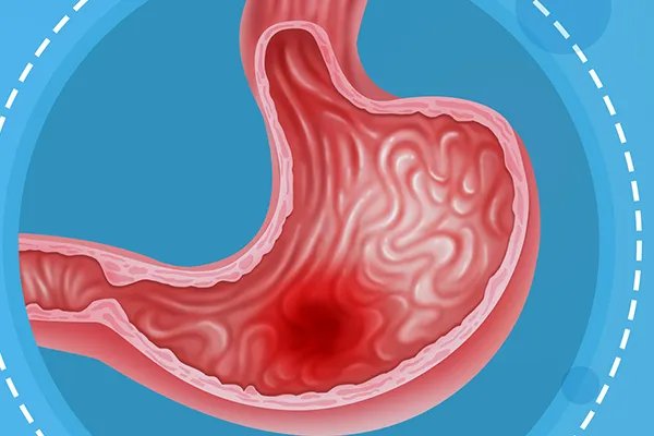 金荞麦的副作用