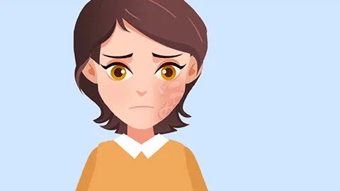 大蒜可以祛斑吗