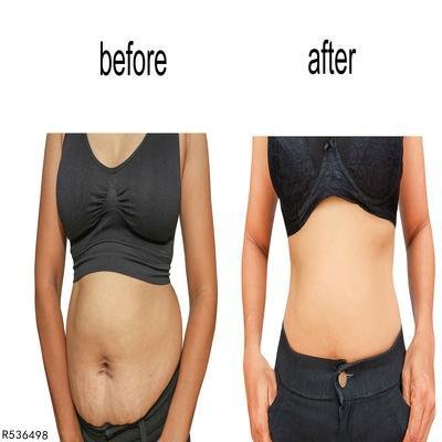 便宜安全的减肥产品有哪些