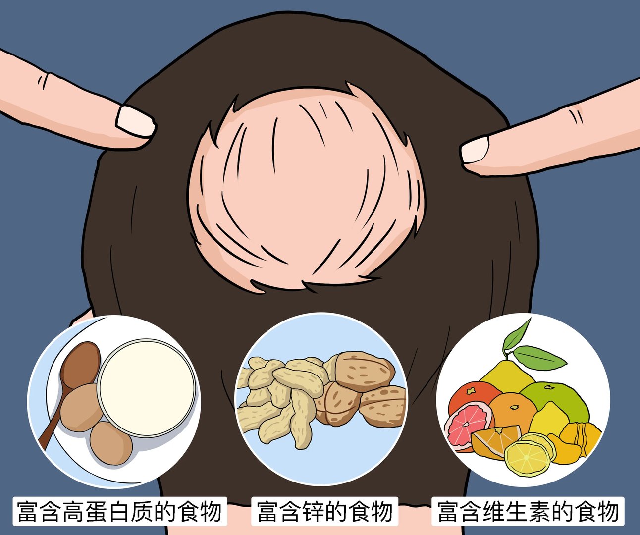 脂溢性脱发吃什么食物好