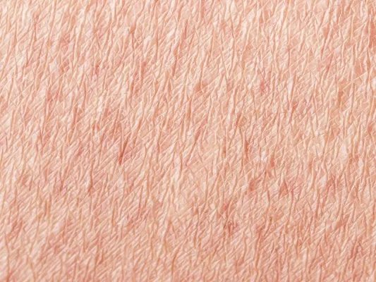 敏感红血丝的症状介绍