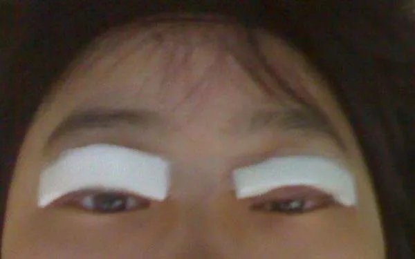 北京好的眼部手术整形医院在哪?