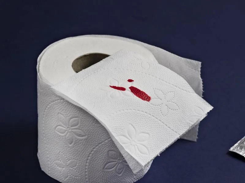 拉屎大量出血的原因