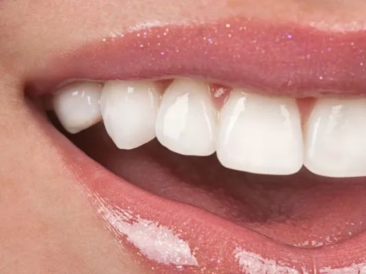 使用苏打粉刷牙的好处