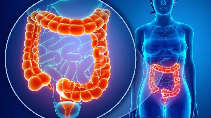 直肠癌晚期治疗方法