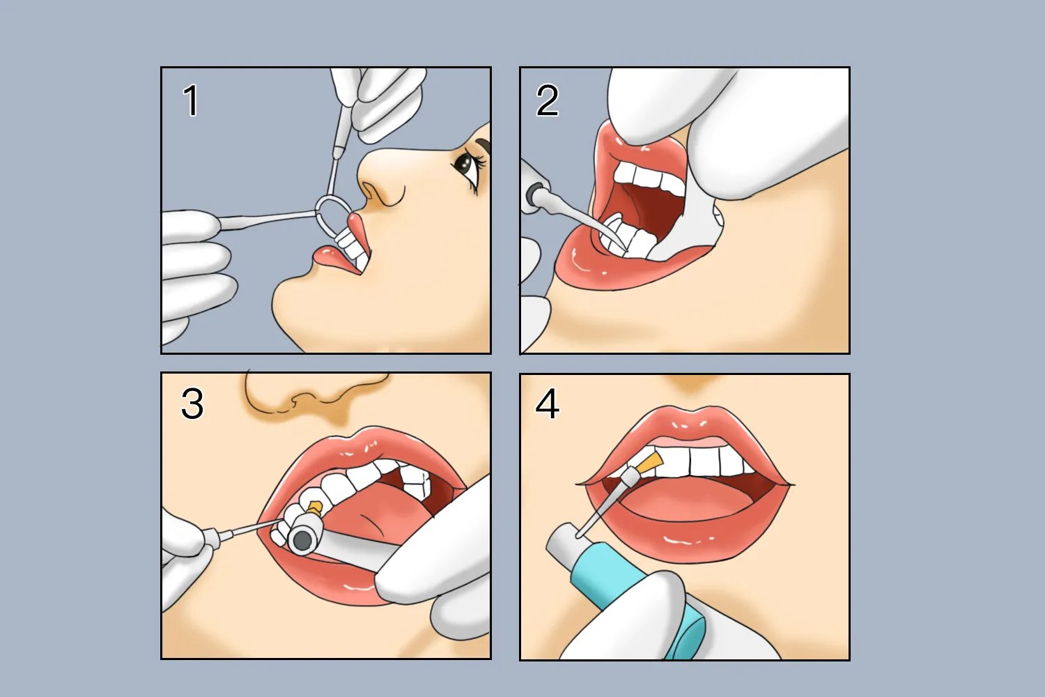 正确洗牙的步骤图解
