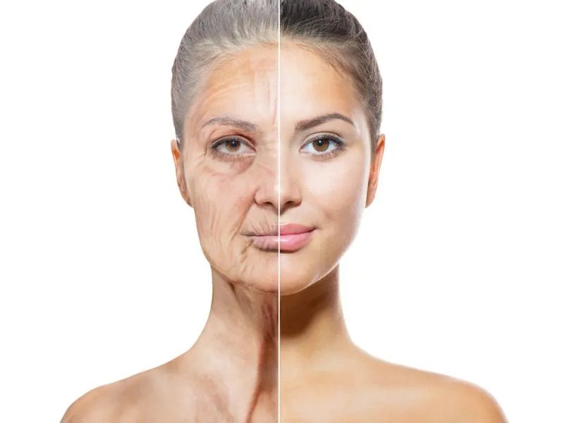 自体干细胞注射除皱