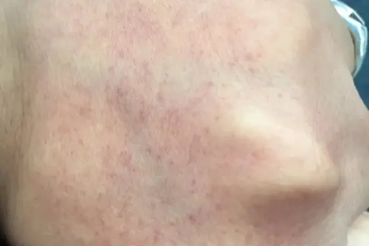 手上突然冒出紫色点点图片