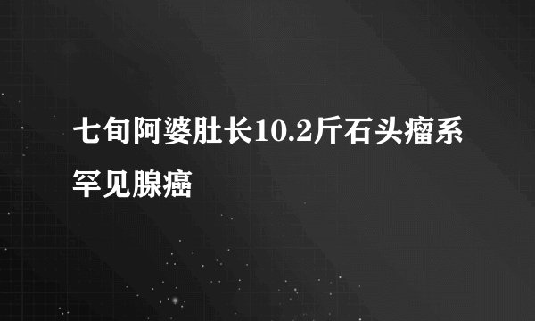 七旬阿婆肚长10.2斤石头瘤系罕见腺癌