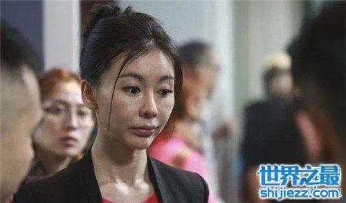 巩新亮整容前后差异大 网友直呼惨不忍睹