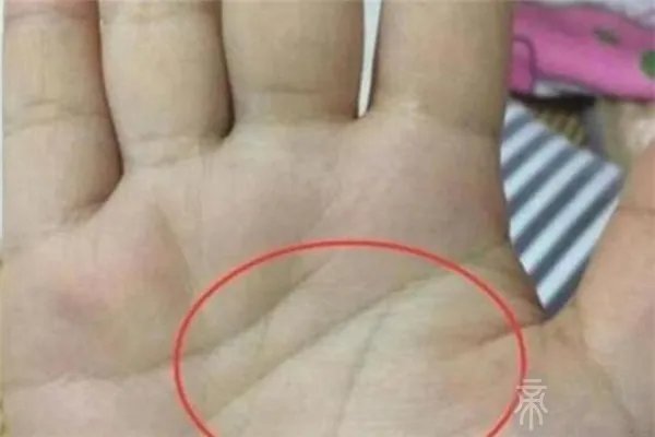 马云手相三角纹放大照