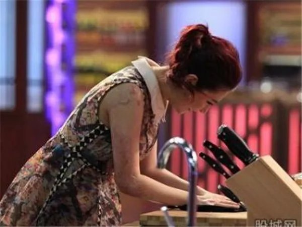 selina现在的照片最新消息 任家萱烧伤前后对比疤痕吓人植皮了吗