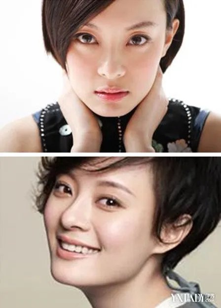 揭露孙俪唇痣车祸造成的内幕稳坐陆剧女王宝座的心酸之路