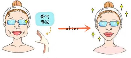 整脸型的费用大概多少