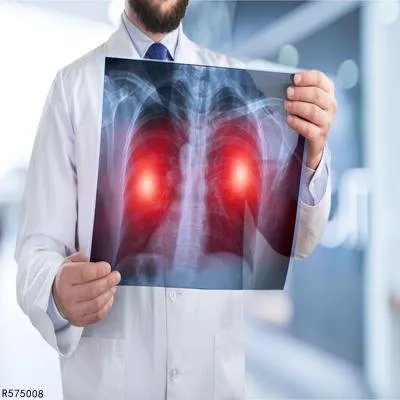 铸工尘肺与特发性肺纤维化的鉴别