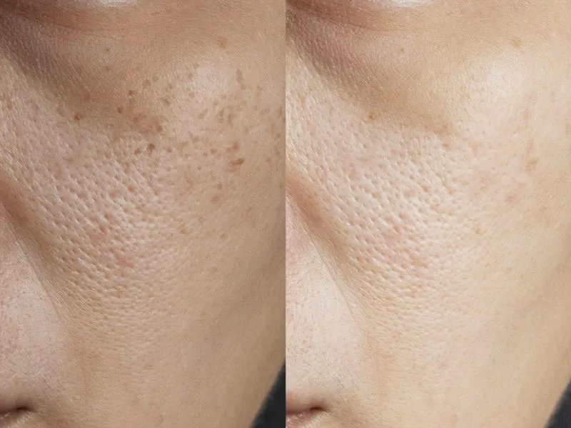 美容美白的食谱