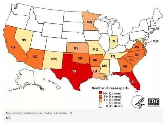 食脑虫正穿越美国向北迁移，食脑虫到底是啥？