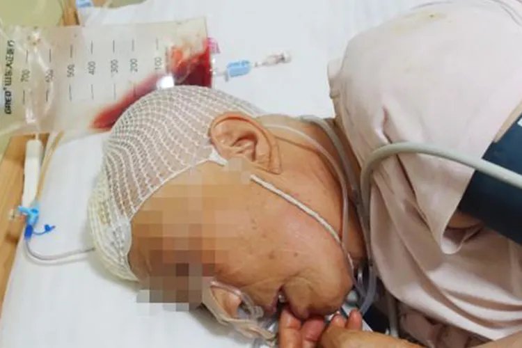 脑充血是什么样的症状