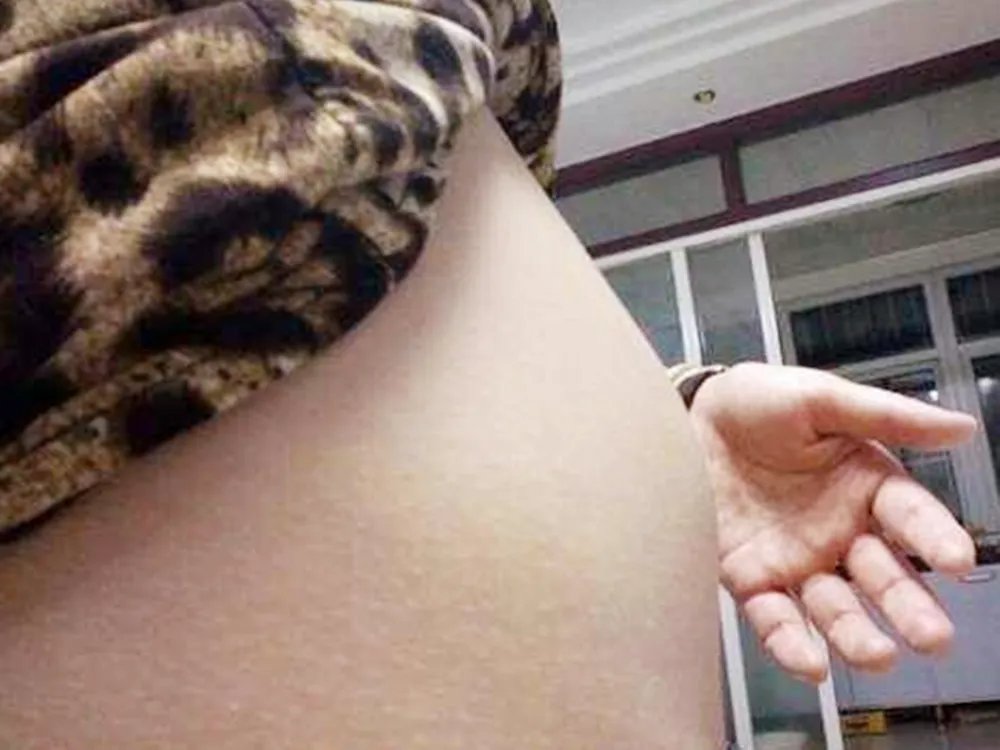 看哪几个部位可以判断女人有没有生过孩子？