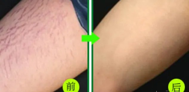 大连除皱整形医院排名_价格表(价目表)一览