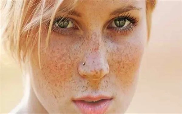 西红柿如何祛斑