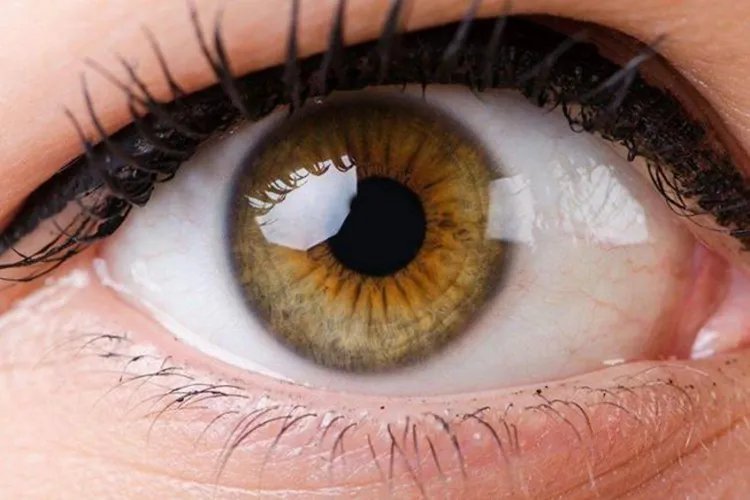 瞳孔放大图片和正常瞳孔图片
