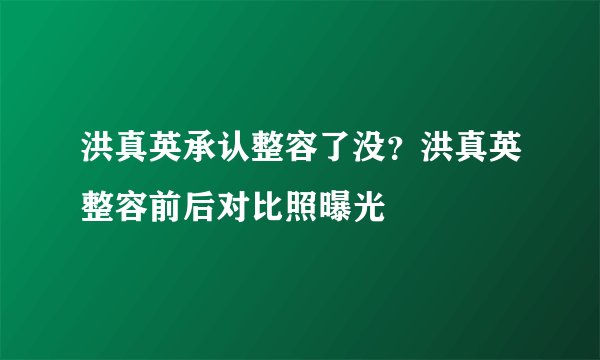 洪真英承认整容了没？洪真英整容前后对比照曝光