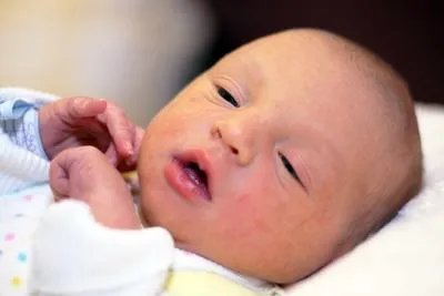 宝宝头发稀少怎么改善