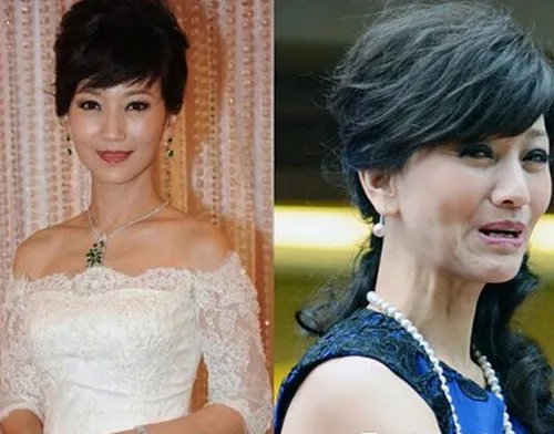 赵雅芝整容失败照曝光 前后对比照片女神都是浮云