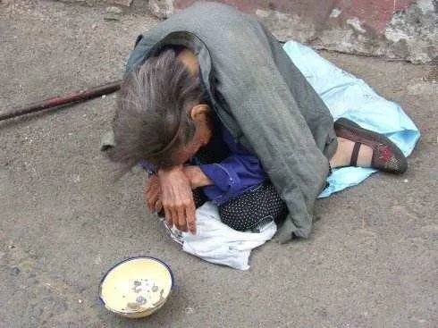 乞讨老汉拦车被撞严重不？