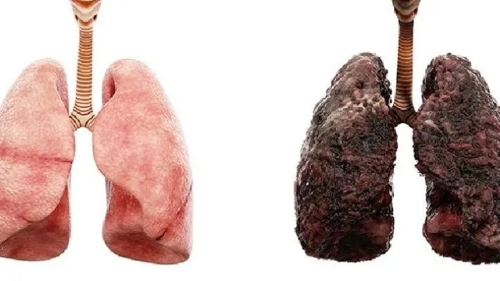 治疗肺纤维化偏方