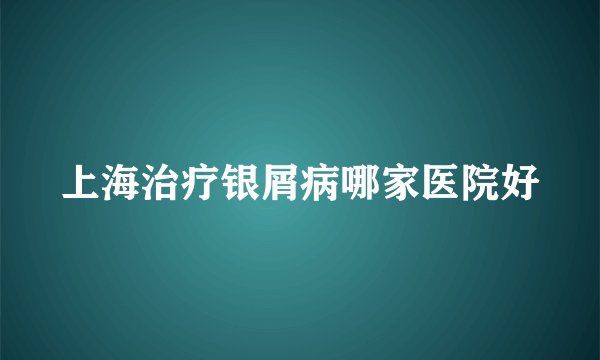 上海治疗银屑病哪家医院好