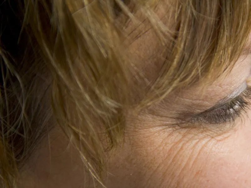 消除细纹的办法