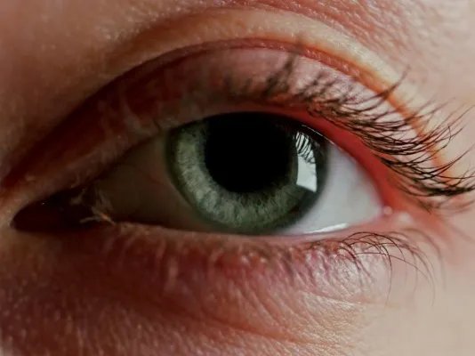 去除下眼睑皱纹的方法有哪些